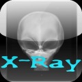 X射线检测系统